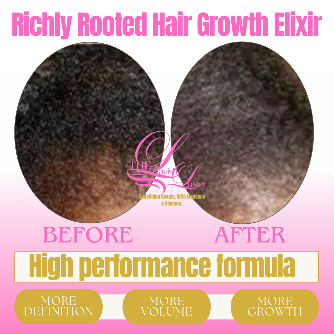 Before and after comparison of hair growth with 'The lavish luster hair oil