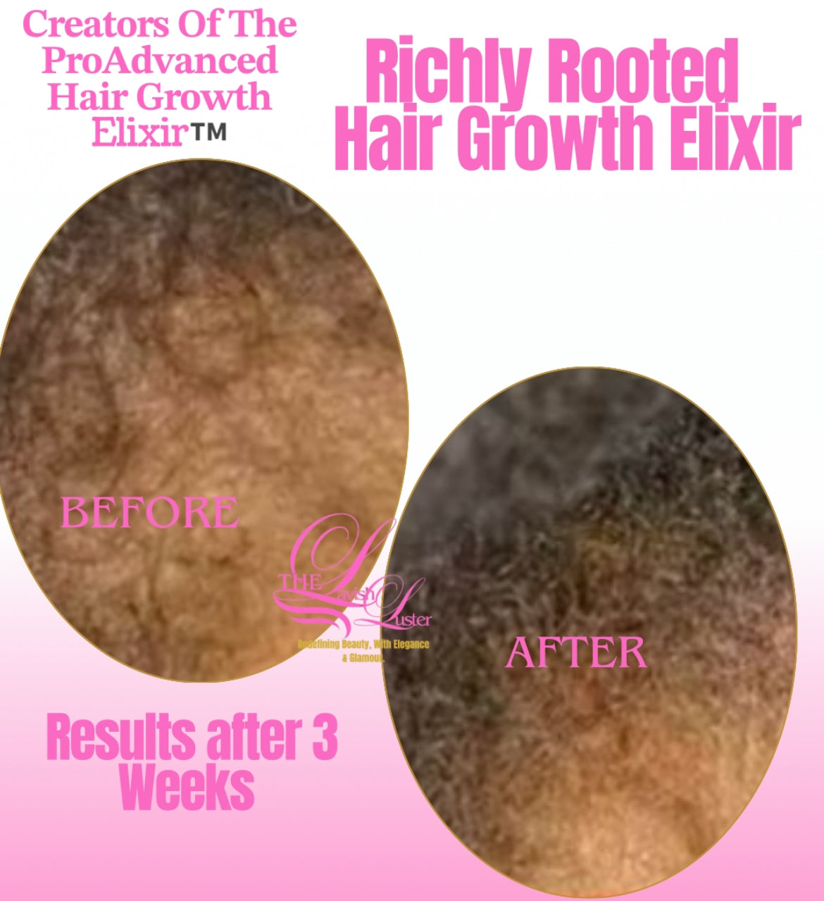 Before and after comparison of hair growth using The Lavish Luster hair growth elixir on a pink background.